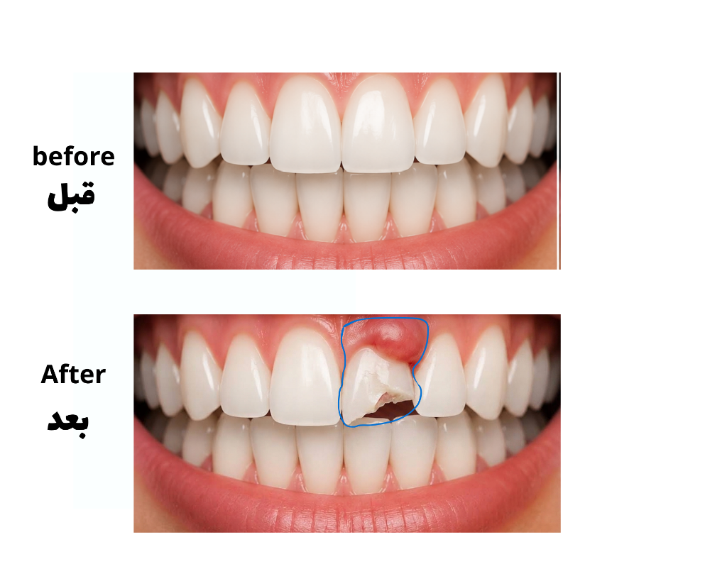 The Problem of Unsafe Tooth Extraction